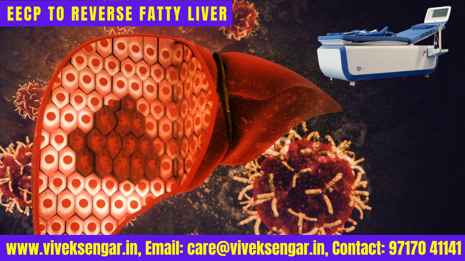 Role of EECP Therapy to Reverse Fatty Liver: A Powerful Integrated Approach
