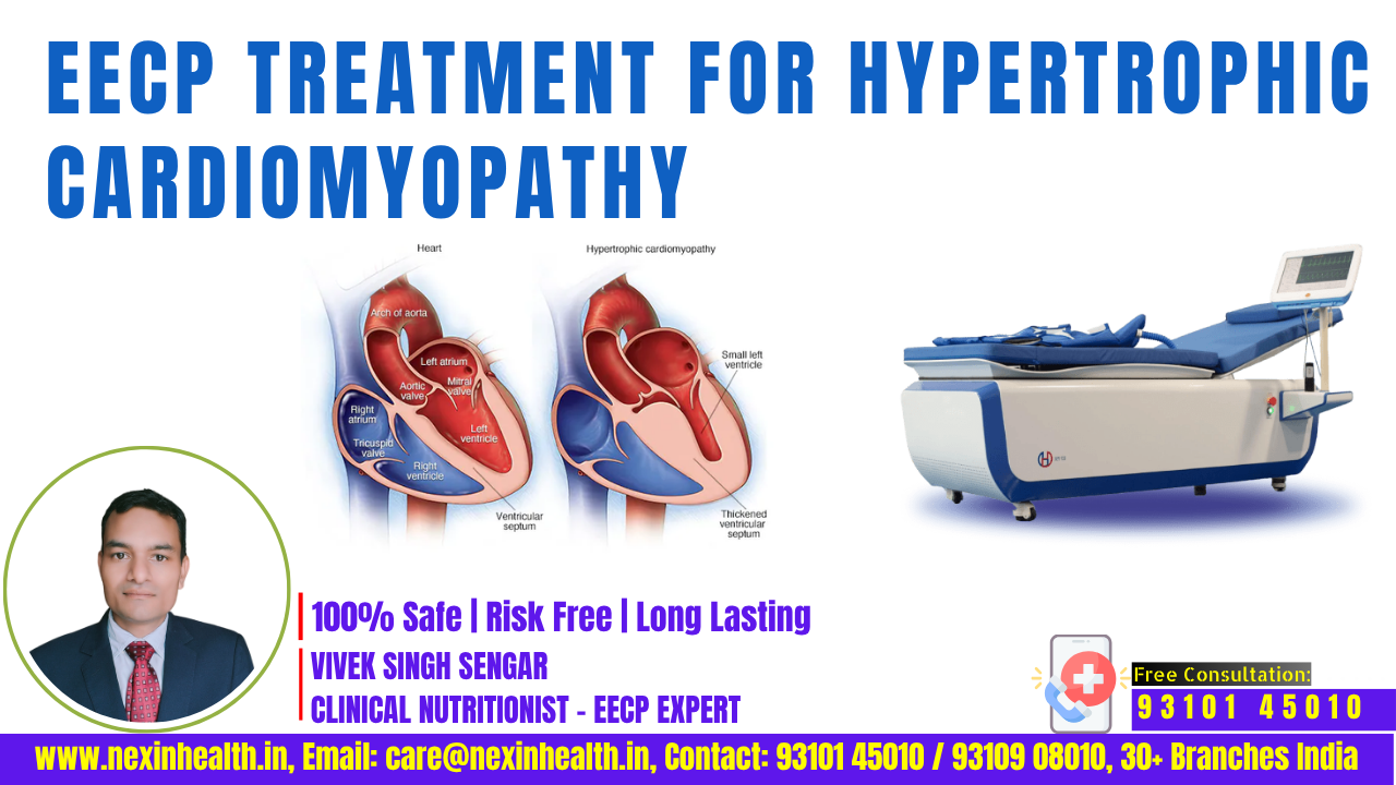 EECP Treatment for Hypertrophic Cardiomyopathy Management: Breaking Barriers for Heart Care