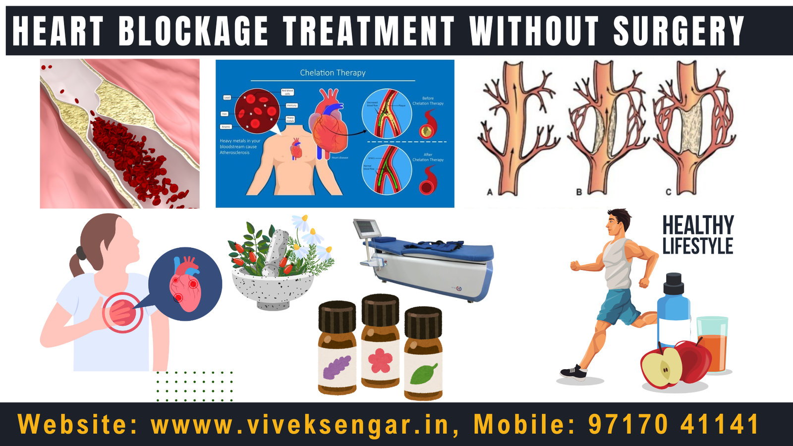 Heart Blockage Treatment Without Surgery: Your Path to a Healthier Heart