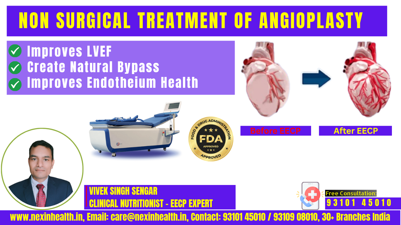 Non-Surgical Treatment of Angioplasty: EECP Therapy – The Revolutionary Alternative to Invasive Procedures